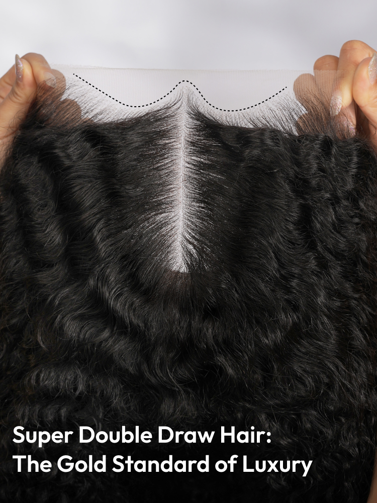 M Hairline