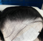 The hairline is everything!